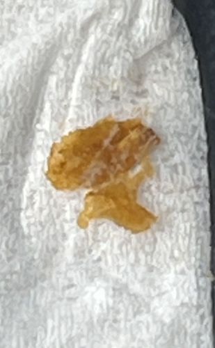 Common Bed Bug (Nymph/Exuviae)