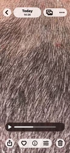 Body Louse / Head Louse (Nits and Adults)