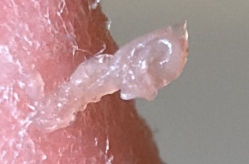 Skin-inhabiting mite (Likely Scabies Mite or Demodex Mite based on appearance)