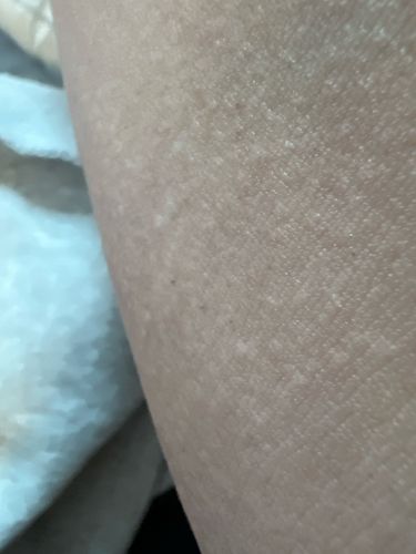 No insect or bug detected