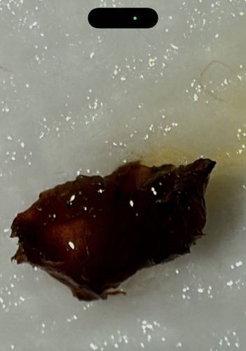 Likely Earwax (Cerumen) or Organic Debris (Not an insect)