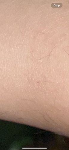 There is no identifiable insect or bug in the image.