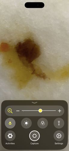Inconclusive (Non-biological residue or crushed insect remains)