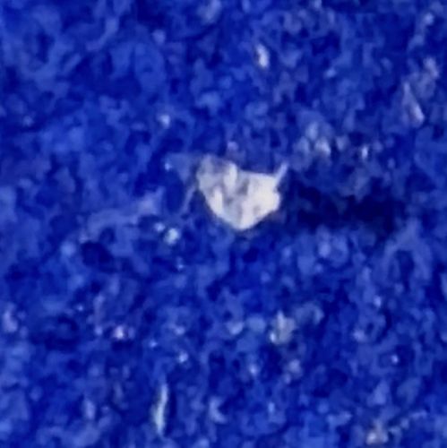 Unidentifiable due to image quality (Possible debris, lint, or moth fragment)