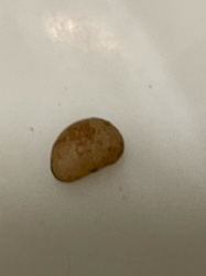 Engorged Dog Tick / Sheep Tick