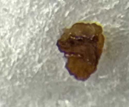 Junk Bug (Lacewing Larva)