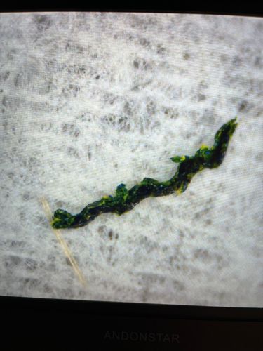 Bagworm Larva (Casemaking Bagworm)
