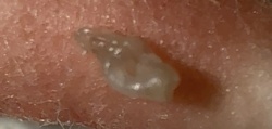 Land Slug