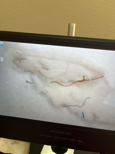 Not an insect/bug; likely textile fibers or dust under magnification