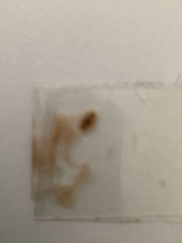 Unidentifiable insect remains/stain