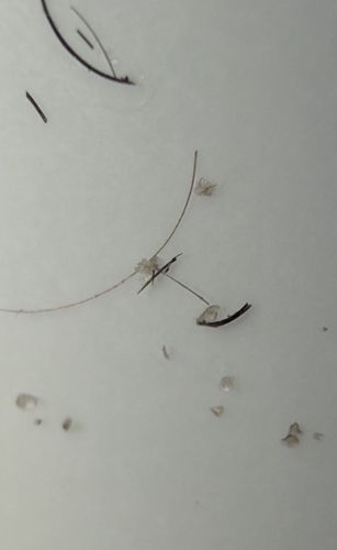 Head Louse (Eggs/Nits)
