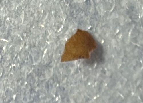 Unknown/Debris (Cannot confidently identify as an insect)