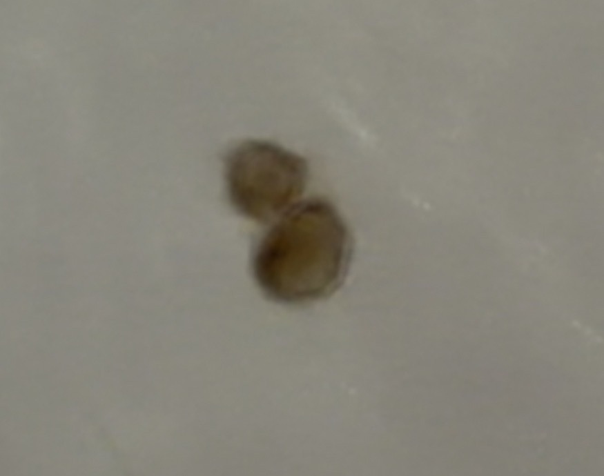 Globular Springtail