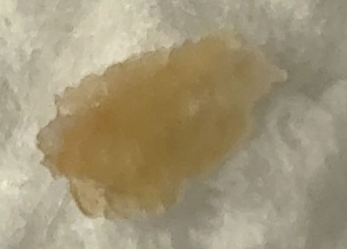 Not a Bug (Likely Earwax, Plant Resin, or Dried Gel)