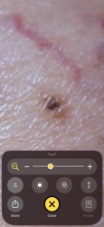 Black-legged Tick (Deer Tick)