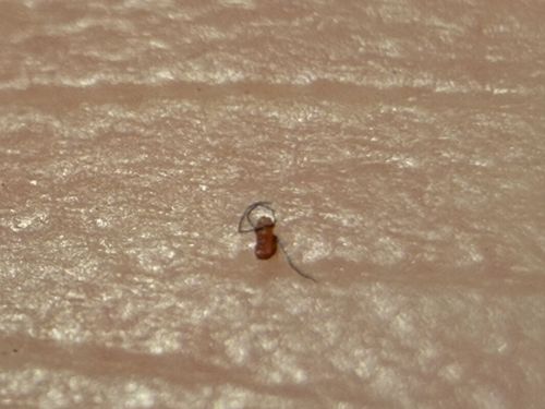 Dog Flea (though closely resembles the Common Cat Flea)