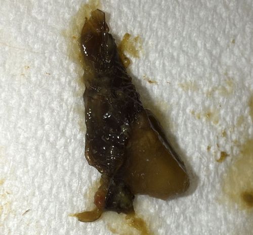 Unidentifiable Organic Debris / Slime Mold / Squashed Slug remains