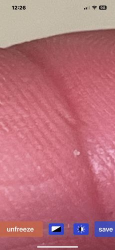 Unable to identify. The image appears to show human skin with a small white object, possibly a speck of debris or part of the skin itself, rather than an insect or bug.