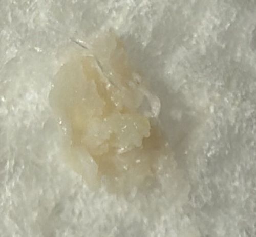 Inconclusive (Likely non-biological or amorphous organic material)