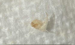 Bird Lice (Louse) / Mite