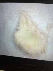 Carpet beetle larvae