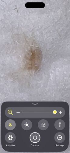 Bed Bug