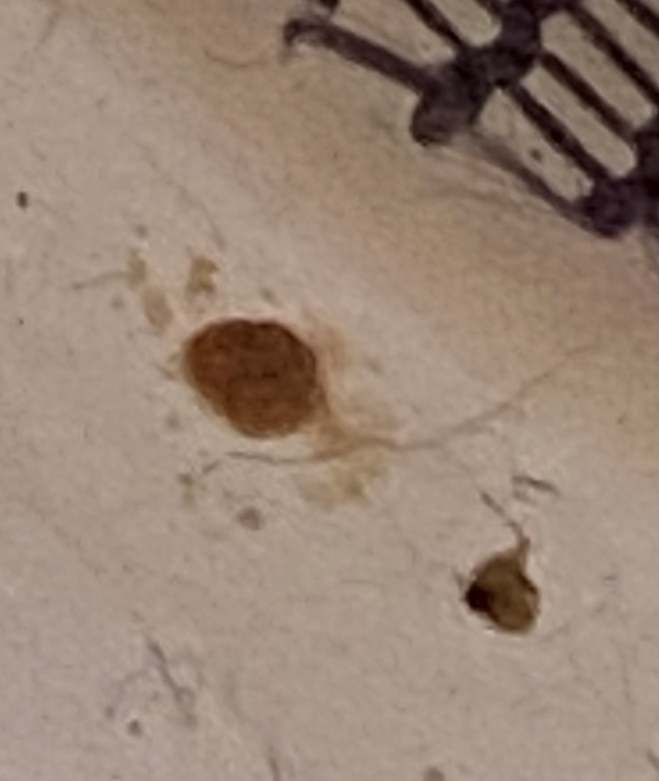 Bed Bug
