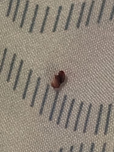 Bed Bug (Exoskeleton/Shell)