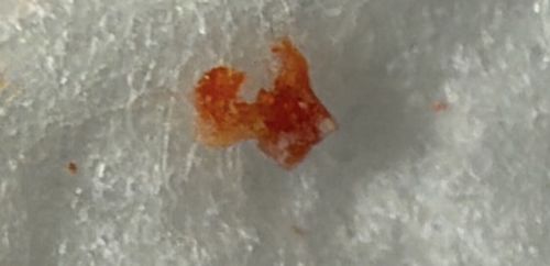 Chigger (Harvest Mite Larva)