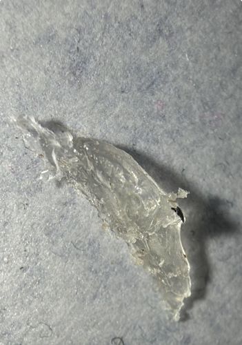 Inconclusive (Non-biological material or artifact)