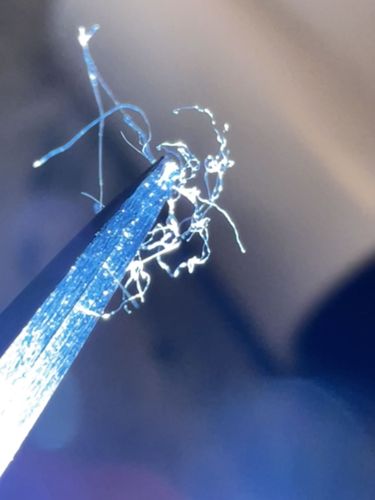 Inanimate fiber (likely synthetic or lint)