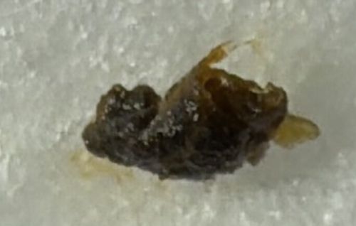 Bed Bug