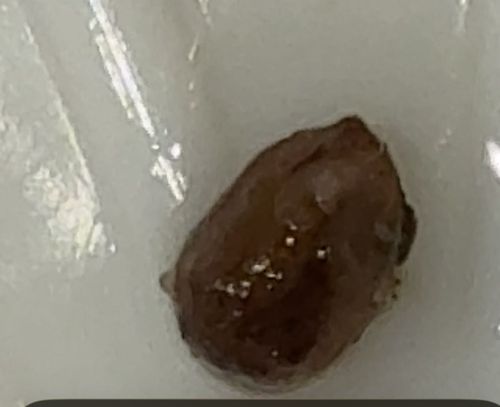 Dog Tick