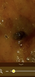 Ant