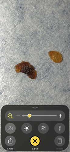 Non-insect specimen (Likely biological debris or skin crusting)