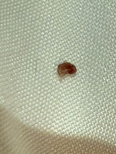 Bed Bug (nymph or partial specimen)