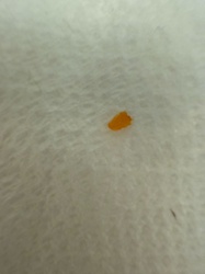 Carpet Beetle Larva (typically Dermestid larvae)