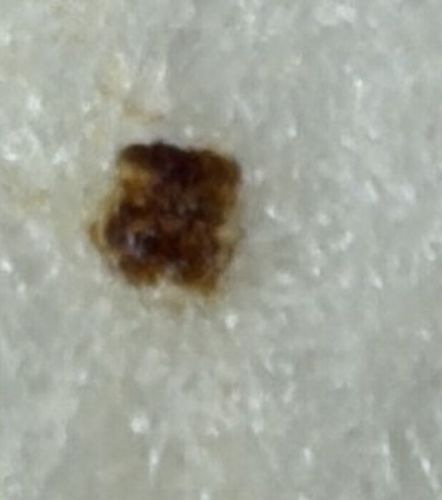 Bed Bug
