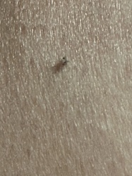 Gnat (likely Biting Midge or Sand Fly)