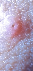 Tick