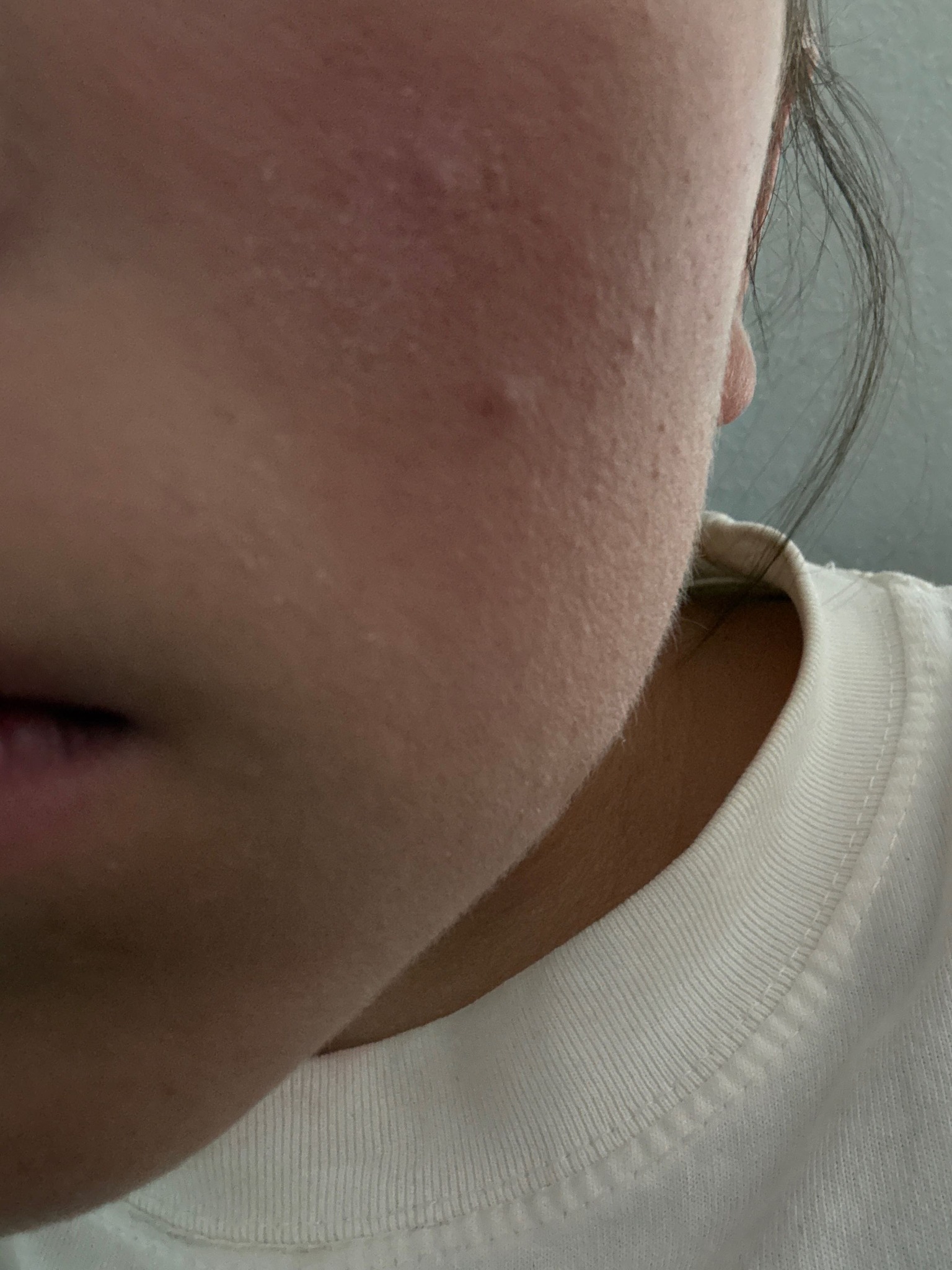 Face Mite