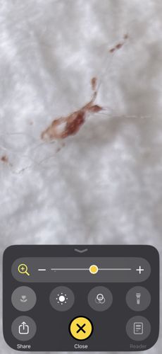 Head Louse