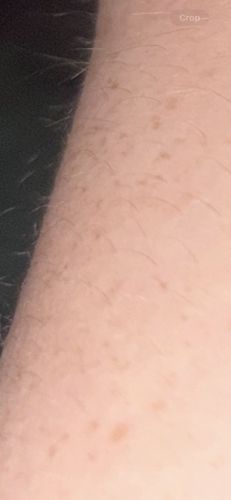 No insect/bug detected