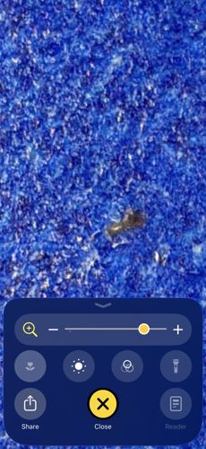 Head Louse