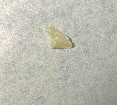 Inconclusive (Likely non-biological debris)