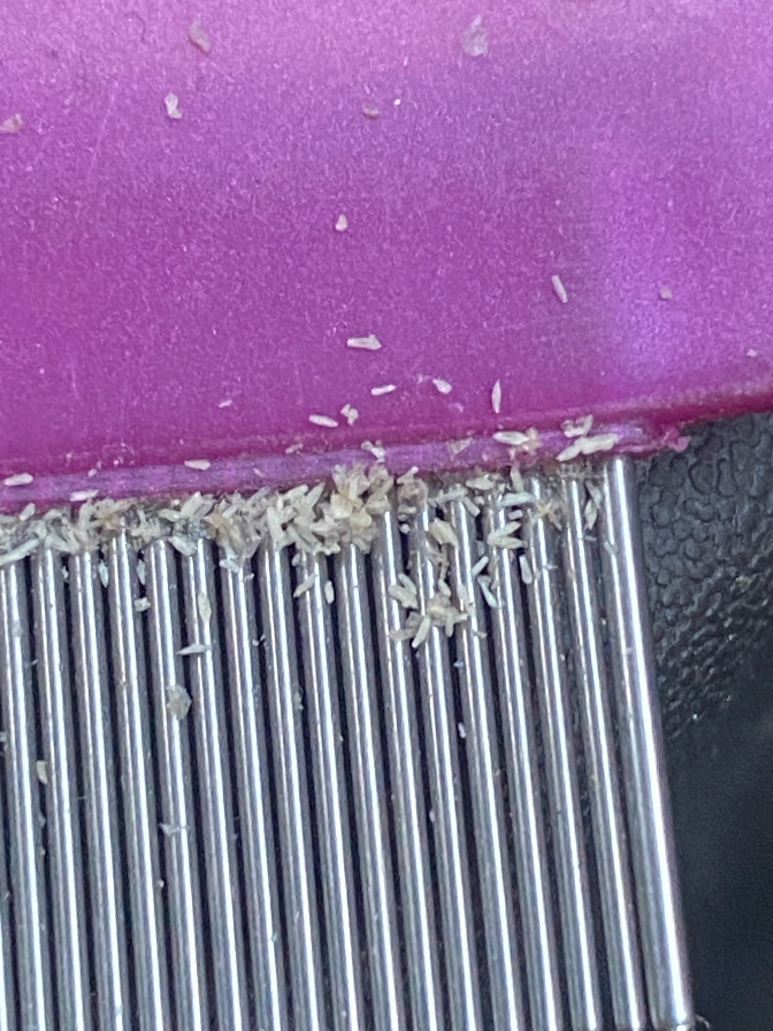 Head louse (eggs/nits)