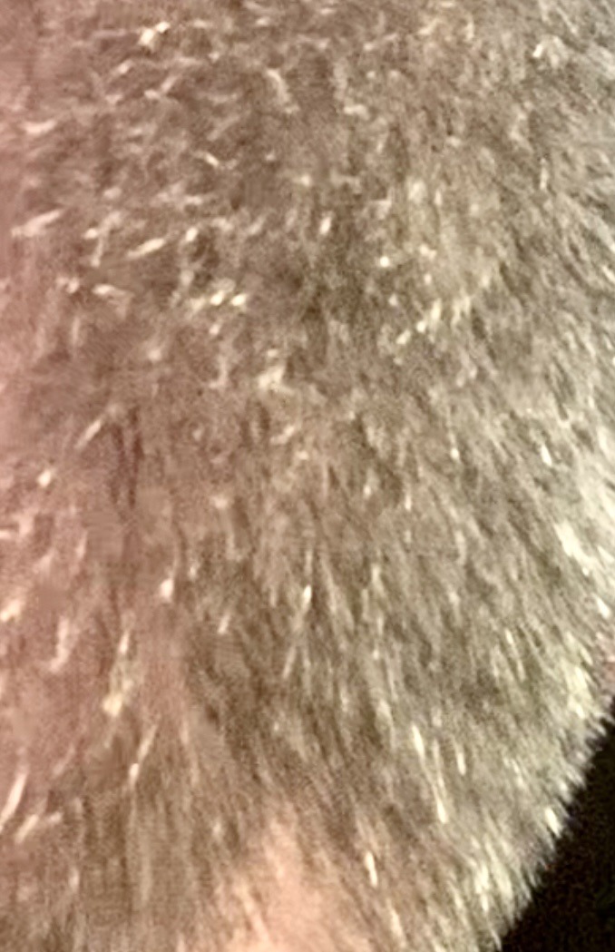 Head Louse (specifically Nits/Eggs)