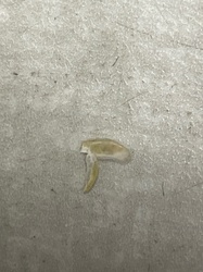 House Centipede (Leg Fragment)