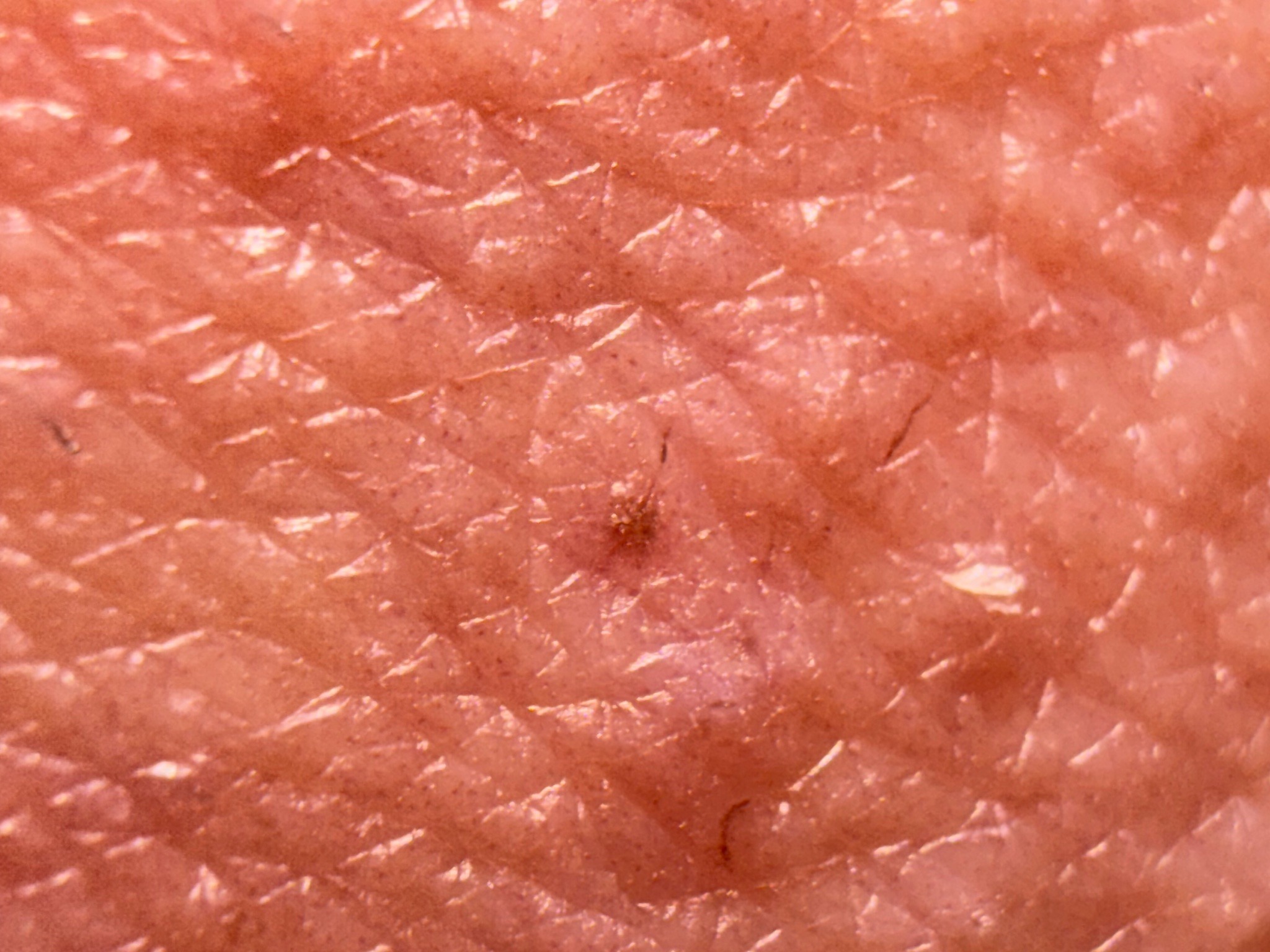 Human flea