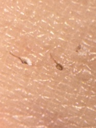 Human flea (likely)